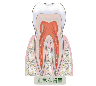 歯周病を理解しよう